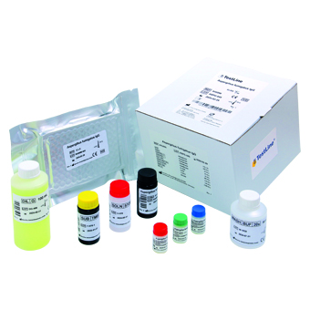 Schistosoma mansoni IgG ELISA